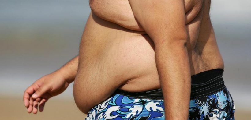 elhízás - elhízott ember strandon