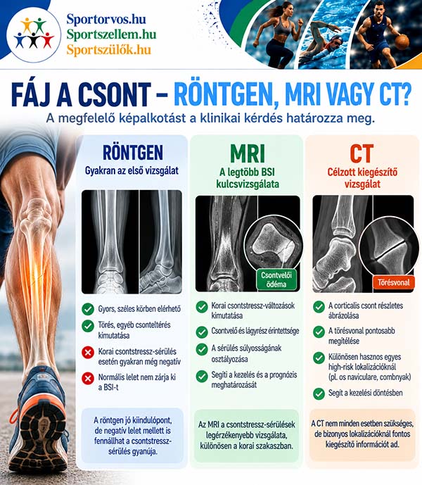 Csontstressz-sérülések sportolóknál – tünetek, diagnózis, kezelés és visszatérés a sportba