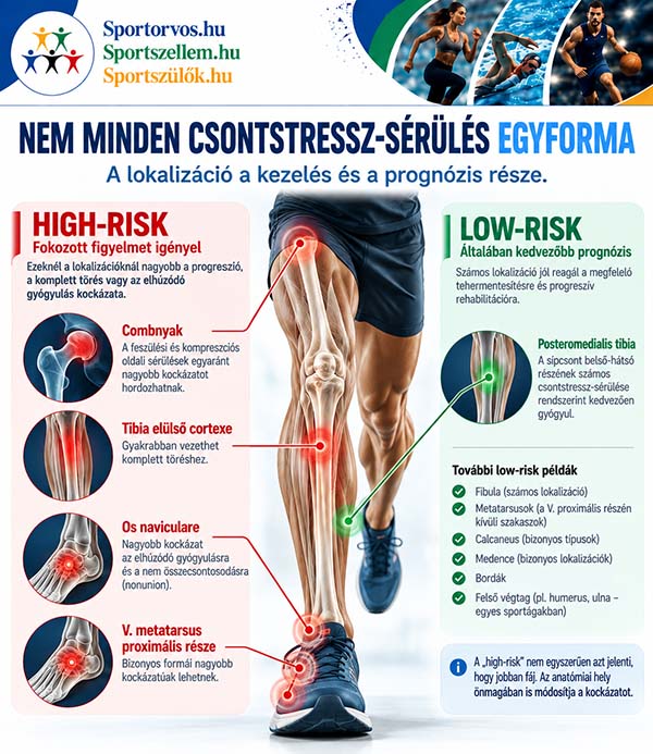 Csontstressz-sérülések sportolóknál – tünetek, diagnózis, kezelés és visszatérés a sportba